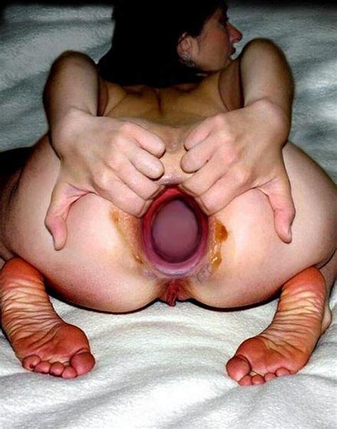 similar image search for post: Is this anal gape real ...